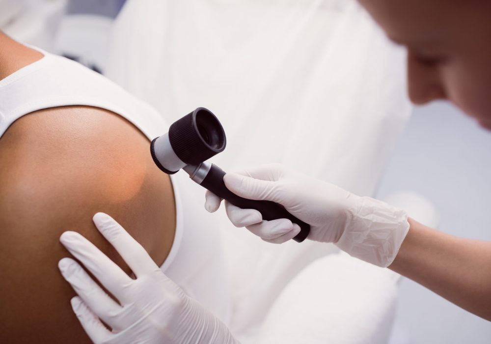 Doctor removing mole with laser treatment in clinic